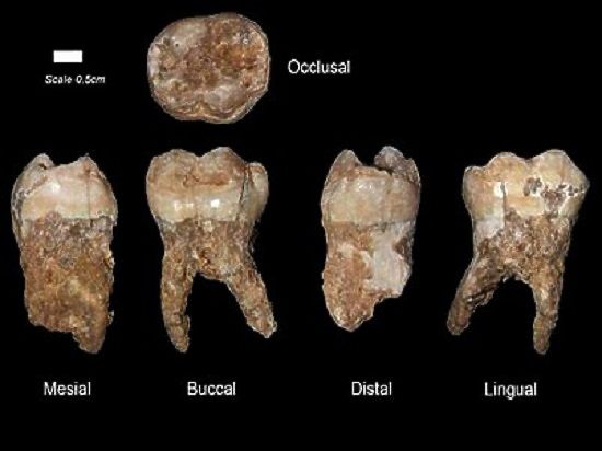 Международная команда специалистов изучила зубной камень, который был обнаружен на постоянных и молочных зубах людей седой древности