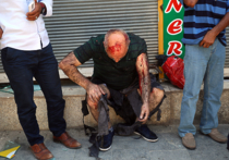 Около тридцати убитых: в Турции у сирийской границы взорвали волонтеров