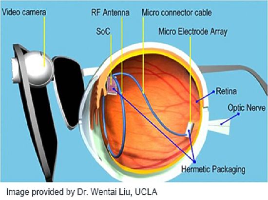 «Это может стать началом новой эры для потерявших зрение» - оперирующий хирург клиники Пауло Странга