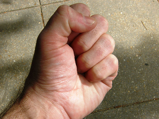 Навальный уже прокомментировал инцидент
