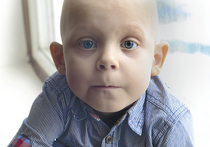 У пятилетнего Никиты Зорина из Ижевска — редкая и агрессивная злокачественная опухоль носоглотки, альвеолярная рабдомиосаркома