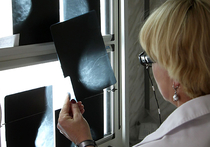 Ежегодно в России диагноз «рак груди» врачи ставят 54 000 женщин (около 19% от всех женских онкологических заболеваний)