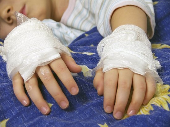 Несвоевременная помощь: оренбурженка несколько дней не показывала ребенка с ожогами доктору