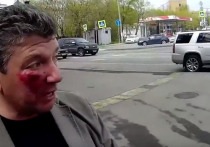 Активисты “СтопХам» обвинили московского депутата в нападении исподтишка