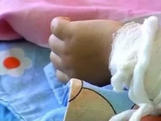 В Илекском районе  9 месячный ребенок  получил многочисленные ожоги 