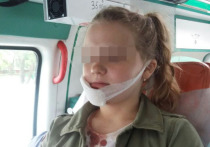 1 июня, участвуя в одном из столичных квестов, 12-летняя Ксюша упала с высоты и распорола подбородок о штырь