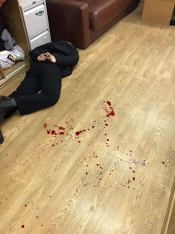 Появились кадры с места ранения ведущей "Эха Москвы" Татьяны Фельгенгауэр