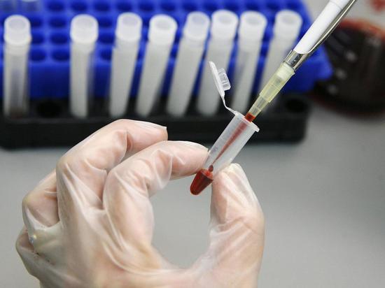 В Костромской области увеличилось количество обследований на ВИЧ