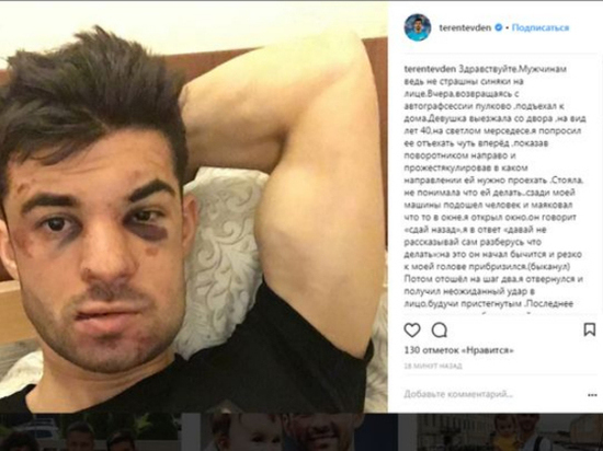 Защитнику «Зенита» Денису Терентьеву сломали нос во время дорожного конфликта