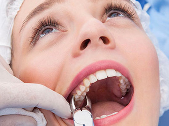 Оренбургский стоматолог сломал пациентке челюсть при удалении зуба