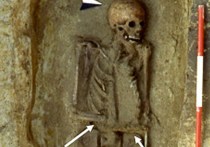 Во время раскопок на территории Ломбардия археологи нашли скелет человека с очень необычным "протезом"