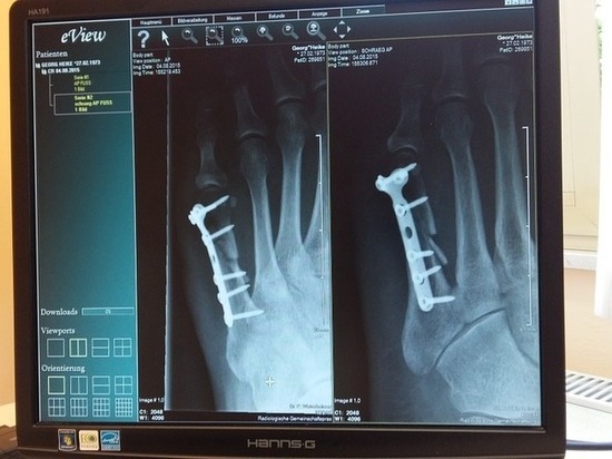 В республиканской больнице монтируют новый цифровой рентген