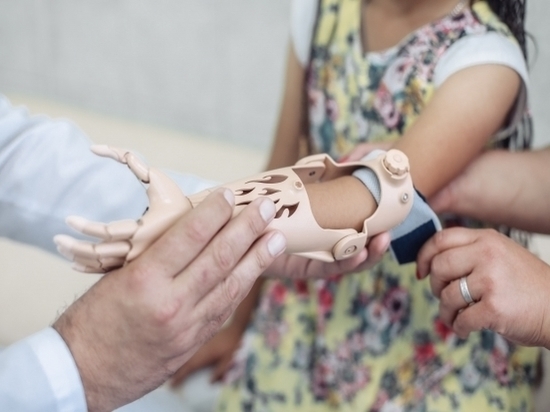Волгоградским детям установили ультрасовременные протезы, напечатанные на 3D-принтере