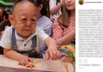 Ребенку из Астаны, который в шесть лет выглядит как старичок из-за редкой генетической болезни, сделали операцию по подтяжке век
