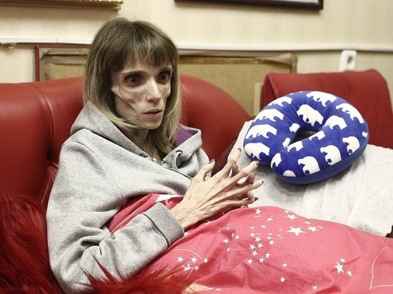 Уже 18 кг: истощенная жительница Барнаула пошла на поправку
