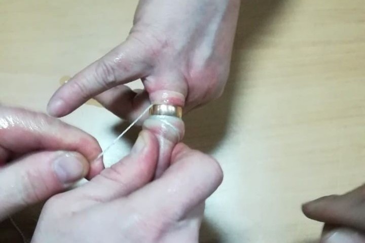 Как снять кольцо