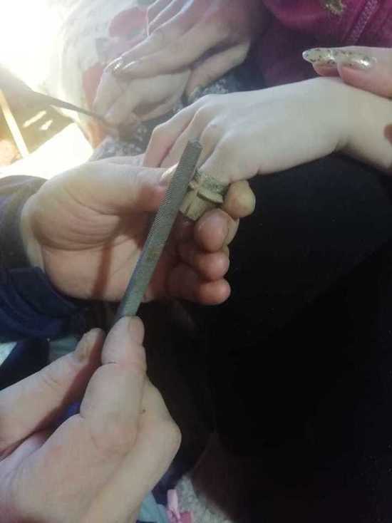 Спасатели Новосибирской области вызволили палец ребенка из плена