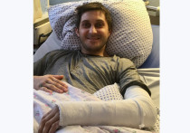 Спасти руку 32-летнего пациента, пересадив ему его же кость, удалось подмосковным врачам