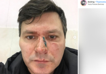 Актёр театра Романа Виктюка Александр Дзюба заявил в социальной сети, что его избил партнёр по труппе Иван Никульча