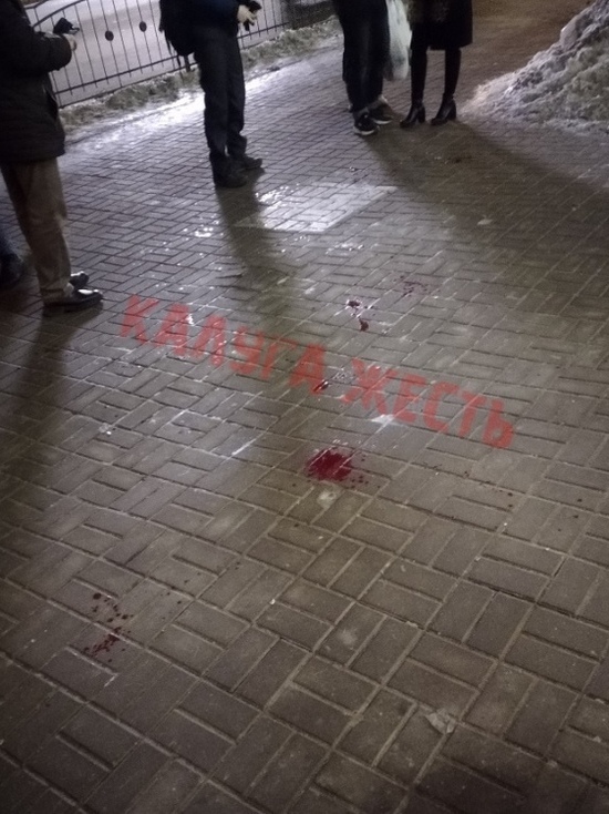 Молодого человека пырнули ножом в центре Калуги