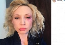 Дочь Аллы Пугачевой, певица и актриса Кристина Орбакайте опубликовала страшное фото в своем Instagram