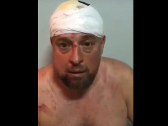 В Харькове жестоко избили лидера местных националистов