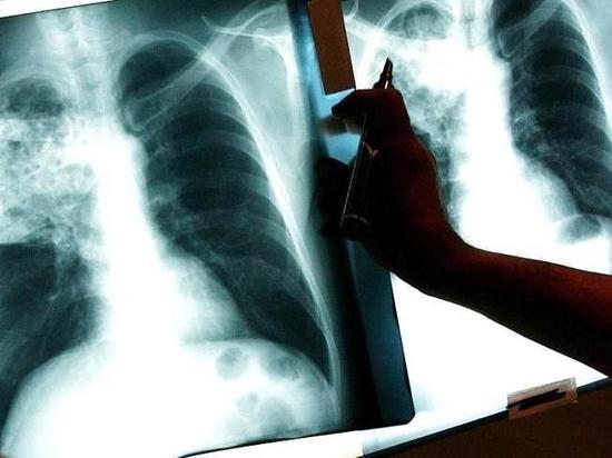 В Ульяновской области стали меньше болеть и умирать от туберкулеза