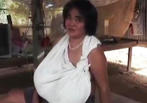 В Таиланде у 46-летней женщины выросла грудь аномальных размеров
