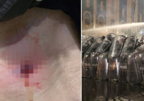 Продюсер видеоагентства Ruptly (является частью RT) был ранен резиновой пулей, снимая протестную акцию возле здания грузинского парламента в Тбилиси