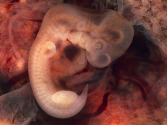 В РПЦ уточнили статус эмбриона