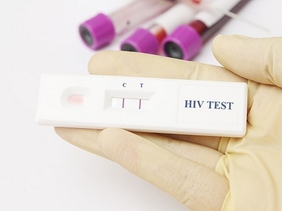 В Хабаровске экспресс-тестирование выявило положительные результаты на гепатит и ВИЧ