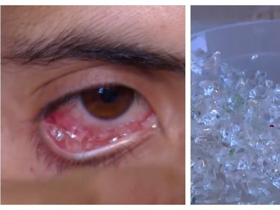 Когда глаз - алмаз. В Уфе готовы помочь армянской девушке, плачущей кристаллами