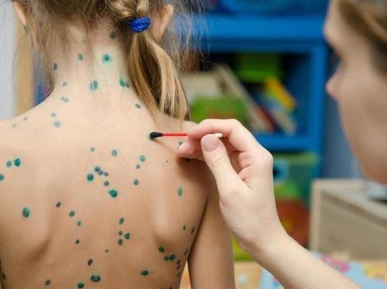 Новосибирским детям нужны дополнительные прививки