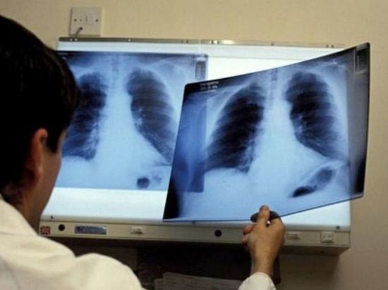 В Костромской области больного туберкулезом отправили на принудительное лечение