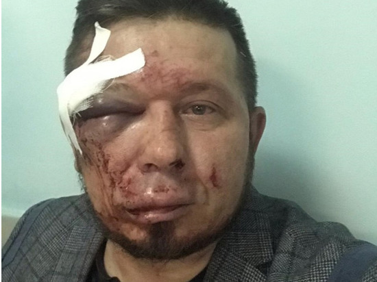 В Новосибирске жестоко избили общественника Андрея Радаева