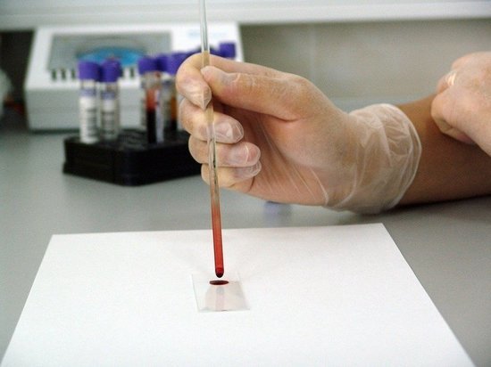 Забайкальцы могут пройти экспресс-тест на ВИЧ 27 и 29 ноября