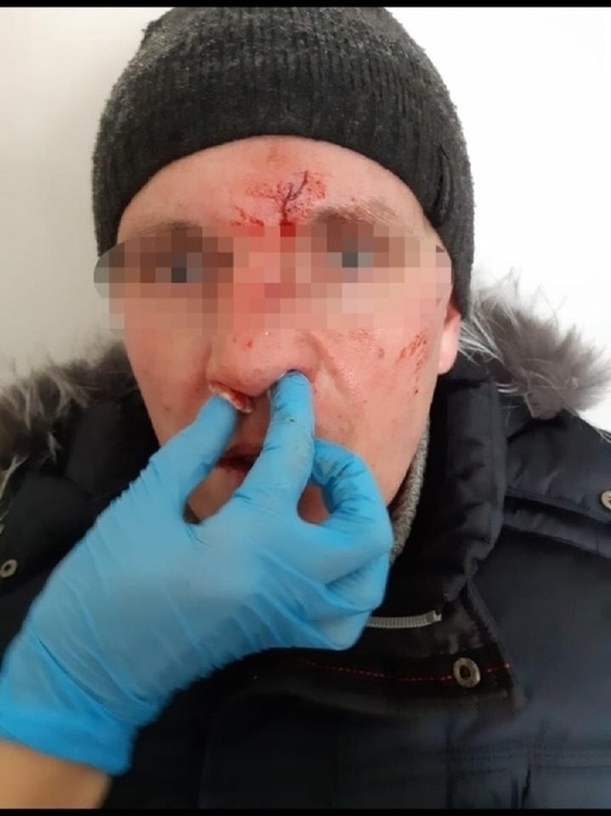 Перелом и сотрясение: мужчина судится с дирекцией Татышева за травмы на катке