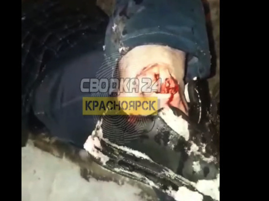 «Поспорили за цену»: пассажир Яндекс.Такси сломал ногу в странной ссоре с водителем