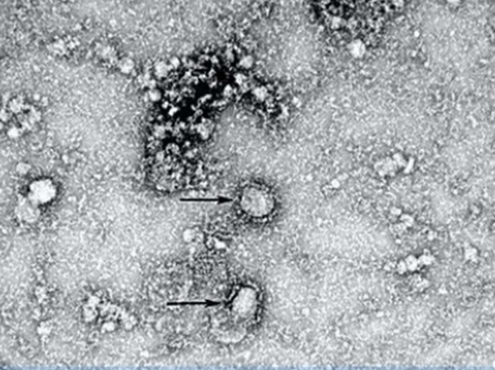 Китайские ученые сфотографировали новый коронавирус
