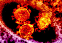 Специалисты, представляющие Институт Доэрти в Мельбурне, сумели вырастить коронавирус нового типа из образца, ранее взятого у одного из заболевших