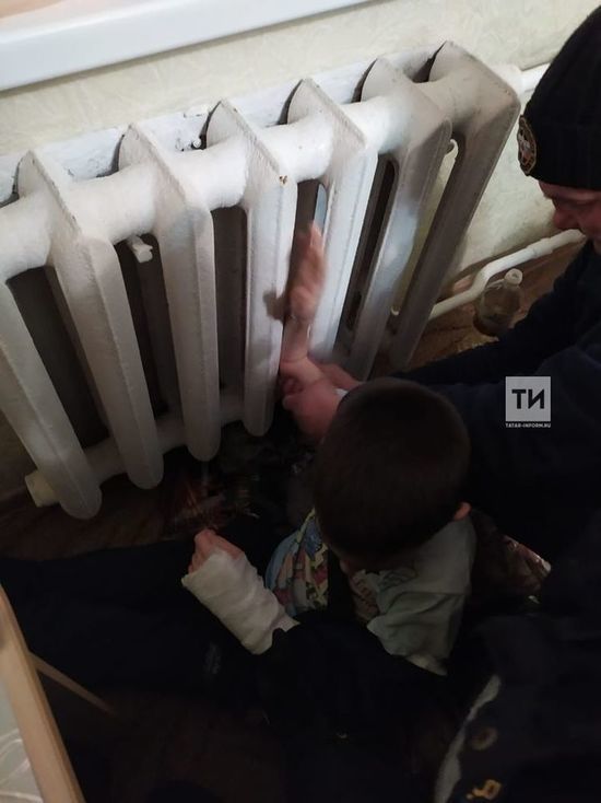 В Казани ребенок рукой застрял в батарее