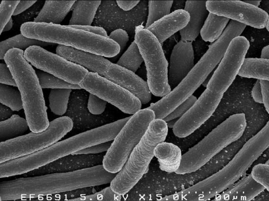 Тверская лаборатория нашла опасные бактерии в котлетах и твороге