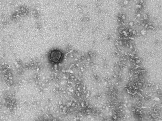 Опубликованы первые снимки коронавируса под микроскопом