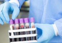 В Соединенных Штатах начали тестировать жителей страны на наличие антител для определения числа зараженных коронавирусом, в том числе бессимптомных носителей COVID-19