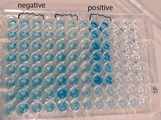 Группа российских биологов создала тест, выявляющий антитела к COVID-19