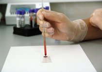 В России разработали новый экспресс-тест на выявление коронавируса, результат которого можно узнать в течение 40 минут