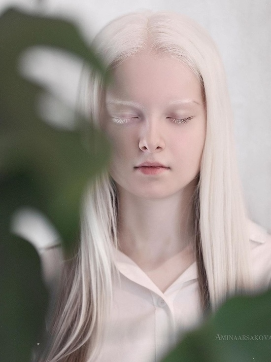 Неземная красота девочки-альбиноса покорила людей из разных стран мира