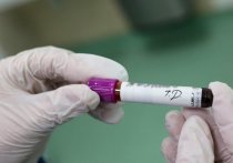 Московские власти объявили массовое тестирование горожан на антитела к СOVID-19
