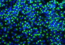 Новое исследование группы ученых из США показало, как коронавирус захватывает клетки организма, блокируя определенные гены, ответственные за борьбу с инфекциями