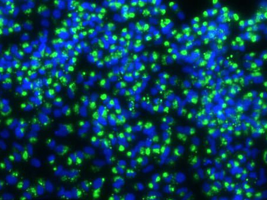 Как COVID-19 перенастраивает иммунитет и препятствует борьбе с ним